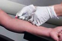 Poziv građanima da se uključe u kupnju dionica Imunološkog zavoda u Zagrebu